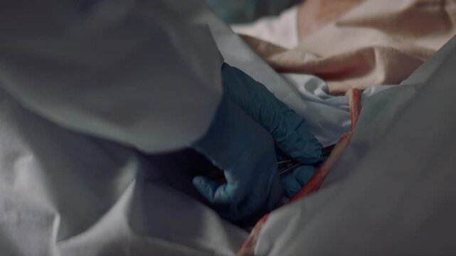 The Umbilical Cord Cutting by a Midwife at Childbirth