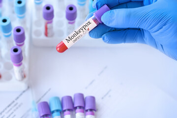 Doctor holding a test blood sample tube with Monkeypox virus (MPXV) .The virus is transmitted from...