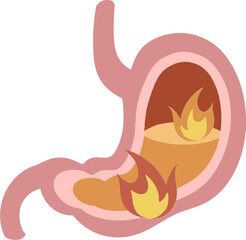 Heartburn colorful flat internal organs illustration