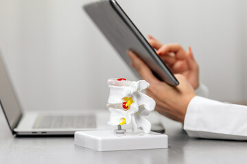 A doctor uses a laptop and tablet at their workstation, with a detailed spine model nearby. Ideal for highlighting modern orthopedic diagnostics and technology integration.