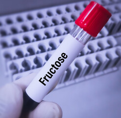 Scientist hold blood sample container with blood for Serum Fructose Qualitative test to diagnosis...