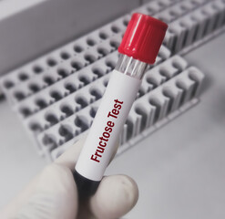Scientist hold blood sample container with blood for Serum Fructose Qualitative test to diagnosis...