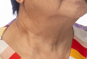 Naklejka premium Neck wrinkles and lines of senior woman. Facial and Neck Skin Aging Change on senior woman.
