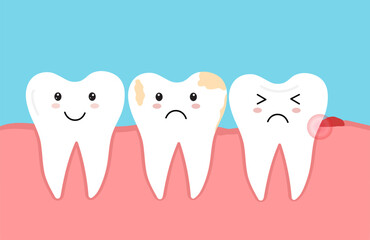 Tooth decay. Plaque terth. Dental caries. Toothache molar. Gum Recession. Vector illustration