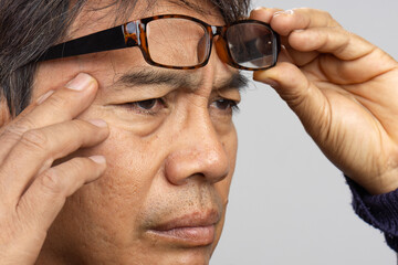 Senior man eye strain after for long stretches at computer or digital screens.