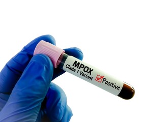 Blood sample for MPox (monkeypox) Clade 1 variant test.
