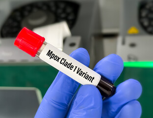 Blood sample for MPox (monkeypox) Clade 1 variant test.