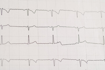 Izolowane badanie EKG serca na papierze z bliska