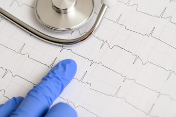 Lekarz kardiolog stawiający diagnozę na podstawie wyników badań © Paweł Kacperek
