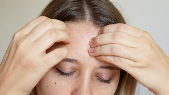 Close up of a young woman picking pimples on her forehead. Acne, hormonal changes on a light background. Problem skin, care and beauty concept. Dermatology, cosmetology
