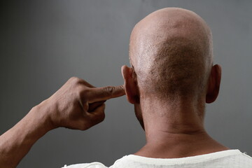man suffering from deafness and hearing loss on gray background with people stock image stock photo	