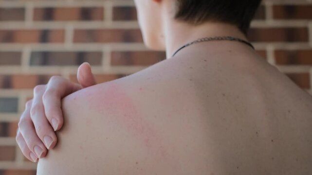 Close-up of a man with reddened skin in the neck area