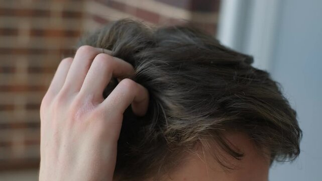 Man scratching his head with his hand close-up. Concept: hygiene, itching, dandruff, allergies