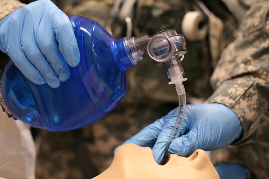 Ventilation of Intubated Patient