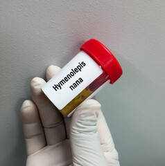 Stool specimen for Hymenolepis nana or H. Nana test.