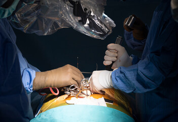 Surgeons who perform spinal cord surgery. Close up surgery team operating in modern hospital