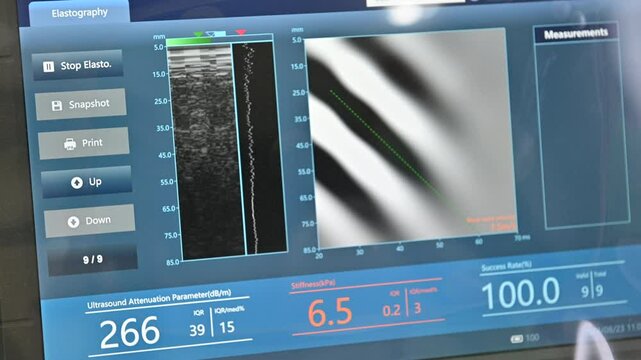 4K Ultrasound screen showing over patient man liver in a modern clinic