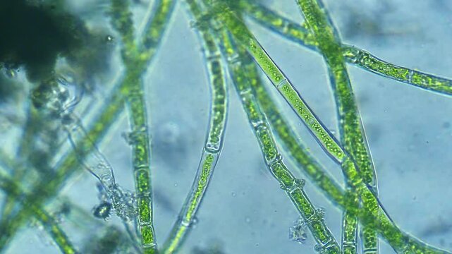 Micro organism Algae - magnification 40x