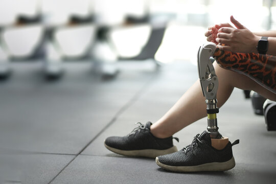 prosthetic, artificial leg. Woman with prosthetic leg using walking on treadmill while working out in gym. artificial leg. Woman wearing prosthetic equipment sit down after exercising in gym.