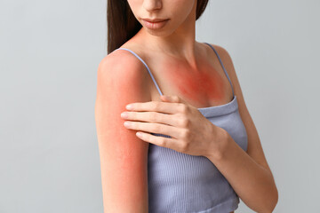 Young woman with red sunburned skin on grey background