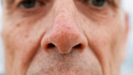 The Nose Details Of A Senior