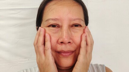 portrait the wrinkle and Flabby skin, swelling and ptosis beside the eyelids, dark spots and blemish, freckles and dullness on the face of middle aged women, health care and beauty concept.