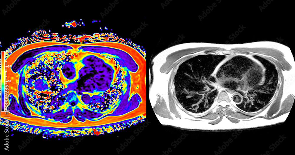 Poster an mri pet scan of the abdomen in axial view provides a detailed cross-sectional image, helping to d