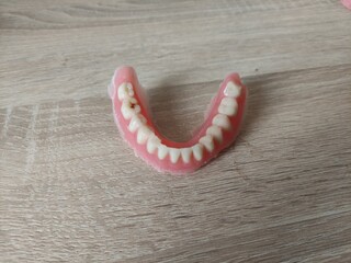 Dental prostheses, dentures on the dentist's table