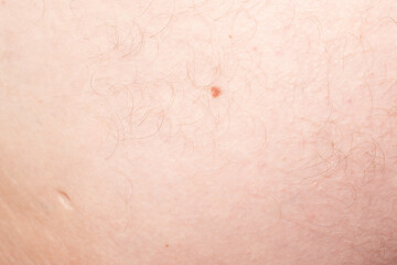 Fototapeta premium A close-up of skin with small moles, perfect for dermatology, skincare, or medical-themed projects.