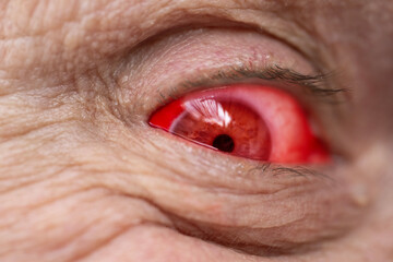 Obraz premium Bloodshot male vampire eye in close-up shot, revealing raw detail burst vessel and underlying stress, symbol of evil and cruelty, state of affect, halloween horror