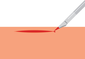 Scalpel vector. lesion vector. Surgery. free space for text. background. copy space.