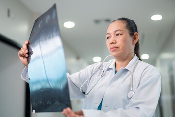 Asian nurse observes the bone structure for any signs of damage. While holding a bone x-ray film.
