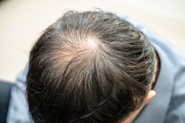 Bald in the middle head and begin no loss hair glabrous of mature Asian business smart active office man.