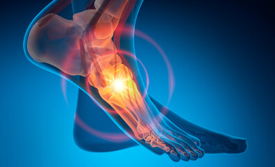 Foot ankle with strong pain symptom - 3D illustration