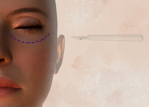Plastic surgery, conceptual illustration