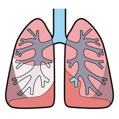 肺　図解