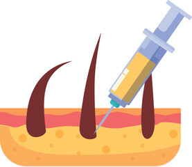 Illustration of a syringe injecting serum into skin for hair growth treatment