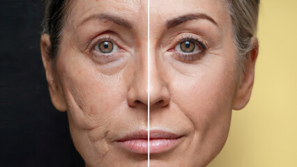 The face of a mature woman before and after rejuvenation or plastic surgery. Anti-aging care and facelift. Modern beauty concept, for design, banner, print, poster, flyer, advertising