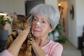 Mischievous cat scratching owner´s face 