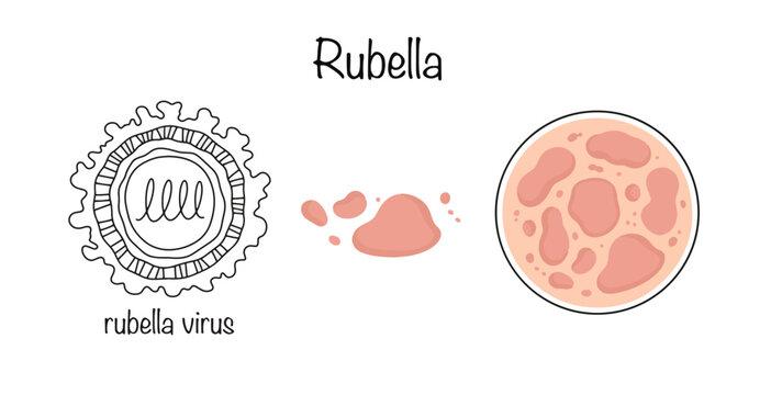 Rubella
