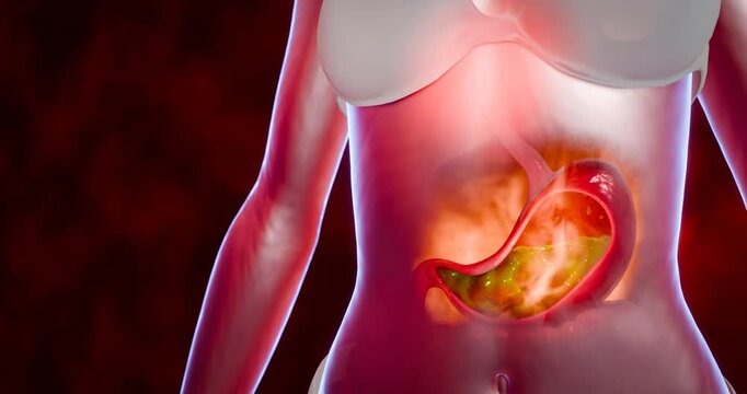 Symptoms of acid reflux or excess acid in the stomach. Gastric juice and intestinal model within the abdominal cavity. Burning sensation in the middle of the chest, acid reflux. 3D Rendering.	