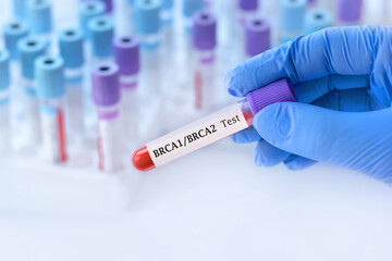 Doctor holding a test blood sample tube with BRCA1 and BRCA2 test on the background of medical test...