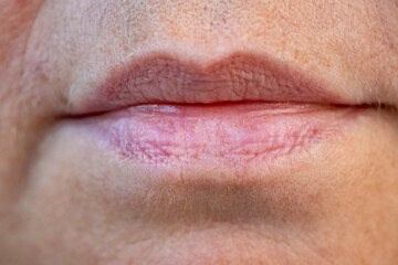 close up part face, lips mature woman 55 years old, wrinkles around mouth, age-related skin...
