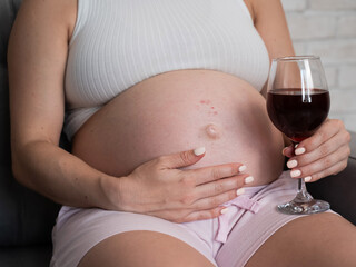 Close-up of the belly of a pregnant woman holding a glass of red wine while sitting on the sofa. Skin rash. 