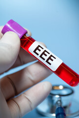 Obraz premium Eastern Equine Encephalitis (EEE) is an extremely rare but serious and often fatal infection that causes encephalitis or inflammation of the brain