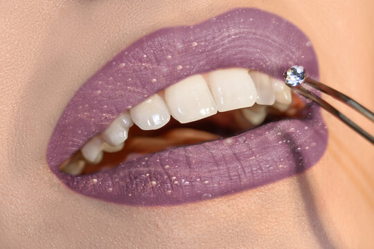 Dentist choosing gemstone or rhinestone for patient's teeth, Close-up mouth and beautiful lipstick with fantastic and fabulous heavenly shine