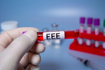 Obraz premium Eastern Equine Encephalitis (EEE) is an extremely rare but serious and often fatal infection that causes encephalitis or inflammation of the brain
