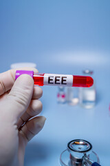Eastern Equine Encephalitis (EEE) is an extremely rare but serious and often fatal infection that...