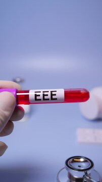 Eastern Equine Encephalitis (EEE) is an extremely rare but serious and often fatal infection that causes encephalitis or inflammation of the brain