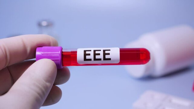 Eastern Equine Encephalitis (EEE) is an extremely rare but serious and often fatal infection that causes encephalitis or inflammation of the brain